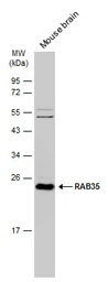 RAB35 antibody [N1C3]
