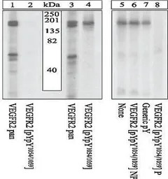 VEGF Receptor 2 (phospho Tyr10