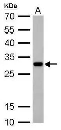 CTDSP2 antibody