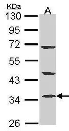 PTER antibody