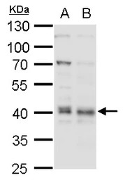 Bmi1 antibody
