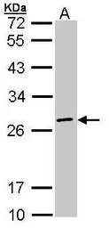 EIF3K antibody [N1C2]