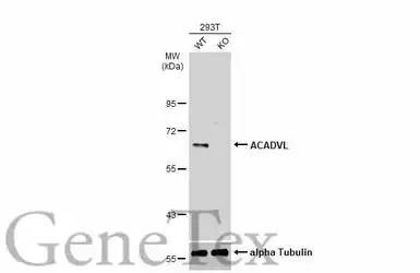 ACADVL antibody [N1C1]