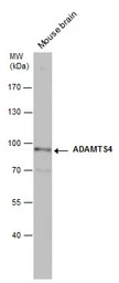 ADAMTS4 antibody [N3C2], Inter