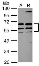 CREST antibody [N1C2]