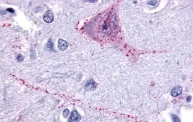 Neurokinin 3 Receptor antibody