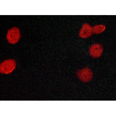 AF6058 Estrogen Receptor-alpha Antibody IF/ICC MCF-7