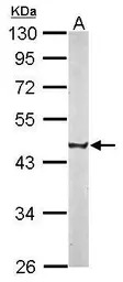 CREST antibody [N1C2]