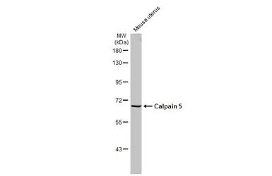 Calpain 5 antibody [N1C1]