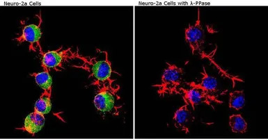 CaMKII alpha (phospho Thr286) 