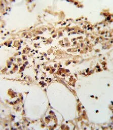 TIMP3 antibody, Internal