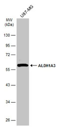 ALDH1A3 antibody [N2C2], Inter