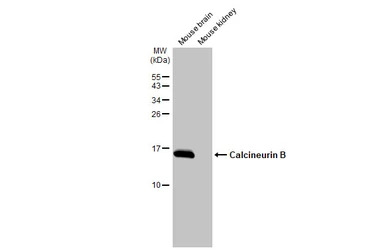 Calcineurin B antibody