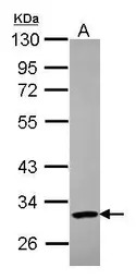 PARP11 antibody
