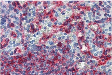 HLA-E antibody [MEM-E/06]