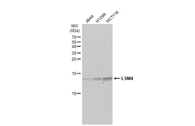 LSM4 antibody [N1C3]