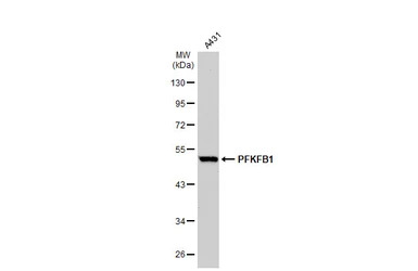 PFKFB1 antibody [N1N3]