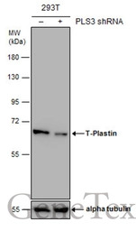 T-Plastin antibody
