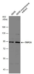 TRPC6 antibody [N1N3]
