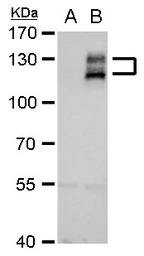 AXL antibody