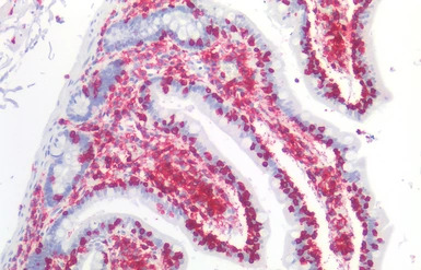 CD45 antibody [MEM-28]
