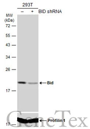 Bid antibody [N1C3-2]