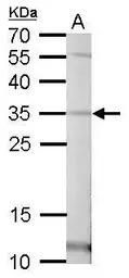 Pirin antibody