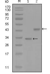 SKP2 antibody [6G9D10]