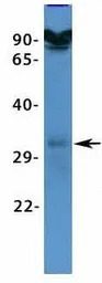 VDAC3 antibody, N-term