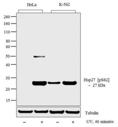 HSP27 (phospho Ser82) antibody