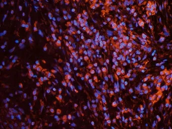 EPO receptor antibody