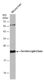 Ferritin Light Chain antibody 