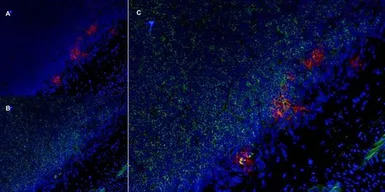 IL2 Receptor alpha antibody [O