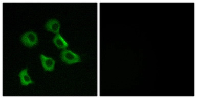 OR52B2 antibody