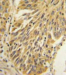 IL1 beta antibody, Internal