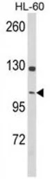 Dynamin 3 antibody, Internal