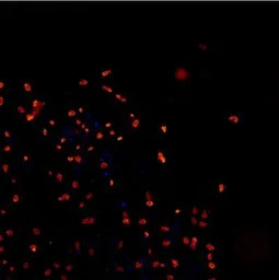 TDP43 antibody (DyLight 550)