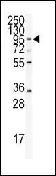 ADAMTS13 antibody, Internal