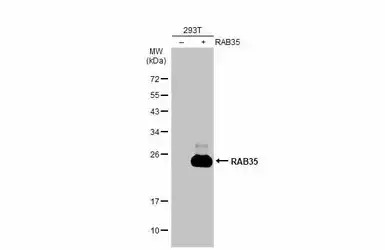 RAB35 antibody [N1C3]