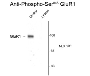 GluR1 (phospho Ser845) antibod
