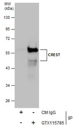 CREST antibody [N1C2]