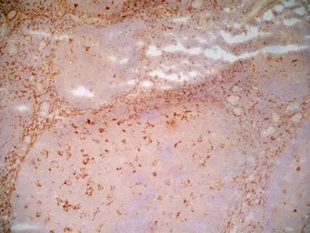 LRP1 antibody [A2Mr alpha-2]