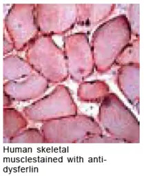 Dysferlin antibody (Ready-to-u