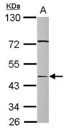 SERPINA12 antibody [N1C1]