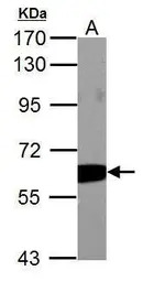 PKM antibody