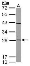 RAB3C antibody [N1C3]