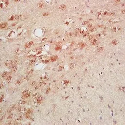 Thyrotropin releasing hormone 