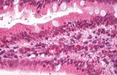 Apolipoprotein B antibody, Int