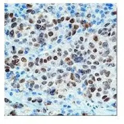 MITF antibody [C5]
