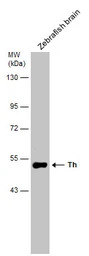 Tyrosine Hydroxylase antibody